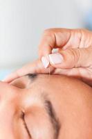 médecin performant faciale acupuncture sur une Jeune Masculin patient photo