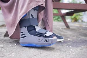 femmes pieds cassés avec une botte en plastique gris chevillère blessure protection botte photo