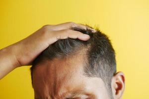 concept de perte de cheveux avec un homme vérifiant ses cheveux photo