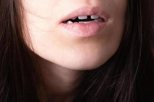 proche en haut de femme ouvert bouche avec écart dents. lèvres et inhabituel les dents photo