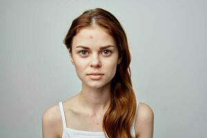 femme avec une bouton sur le visage cosmétologie studio photo