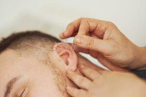 une image de une homme ayant acupuncture sur oreille photo