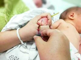 fermer mains de pédiatrique infirmière en utilisant iv cathéter poignarder sur malade nouveau née bébé main et drainé le sien du sang à du sang tube pour à vérification glucose et tout virus dans le sien du sang à nicu quartiers. photo