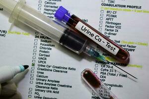 urine Californie - tester avec du sang goûter. Haut vue isolé sur Bureau bureau. soins de santé médical concept photo