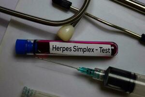 herpès simplex - tester avec du sang goûter. Haut vue isolé sur Bureau bureau. soins de santé médical concept photo