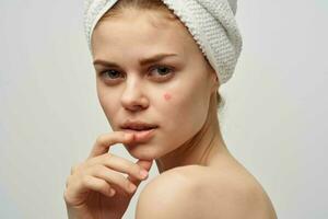 jolie femme avec une bouton sur le visage cosmétologie studio photo