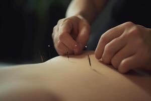 fermer de acupuncture aiguilles inséré dans peau avec mains mis sur Haut ai généré photo