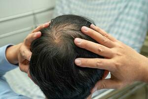 chauve au milieu de la tête et ne commence pas à perdre les cheveux glabres d'un homme de bureau actif et intelligent d'affaires asiatiques matures. photo