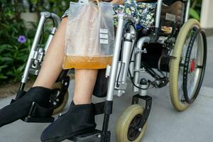 asiatique Dame invalidité patient séance sur fauteuil roulant avec urine cathéter drainage sac dans hôpital. photo