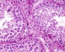 cellules de leydig testiculaire photo
