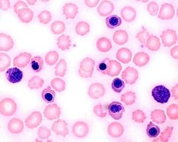 érythroblastes de frottis sanguins photo