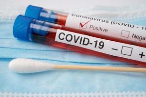 Tube à essai de sang de l'échantillon de virus ou de coronavirus covid 19 dans le laboratoire de l'hôpital