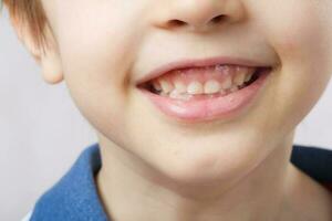 les dents de une 6 ans vieux enfant photo