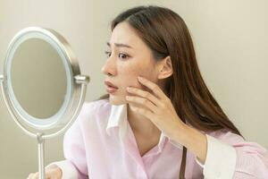 dermatologie, expression visage inquiéter asiatique Jeune femme à la recherche miroir main toucher faciale à foncé place de mélasma, taches de rousseur de pigment la mélanine, allergie Soleil. beauté se soucier, peau problème traitement, soin de la peau photo