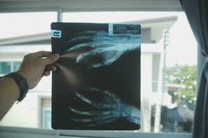 médecins discuter plus de médical radiographie dans clinique photo