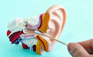 oreille nettoyage avec coton écouvillons. anatomique oreille modèle. photo