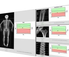 spécial examen médical image OS densité. photo