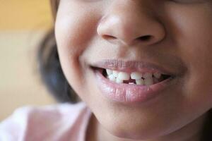 détail coup de enfant avec les dents disparu photo