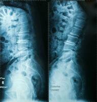 radiographie image, vue de cou Hommes pour médical diagnostic. photo