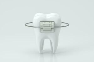 dentaire un appareil dentaire et le dents, 3d le rendu. photo