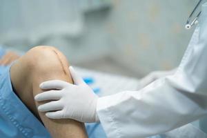 Une patiente asiatique âgée montre sa cicatrice de remplacement de l'articulation du genou