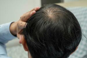 chauve au milieu de la tête et ne commence pas à perdre les cheveux glabres d'un homme de bureau actif et intelligent d'affaires asiatiques matures. photo