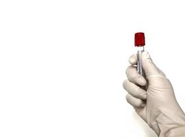 Main portant un gant tenant un tube à essai sanguin sur fond blanc photo