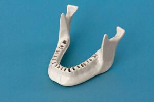 plus haut Humain mâchoire sans pour autant les dents modèle médical implant isolé sur bleu Contexte. en bonne santé dents, dentaire se soucier et orthodontique concept. photo