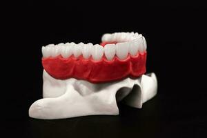 inférieur Humain mâchoire avec les dents anatomie modèle isolé sur noir Contexte. en bonne santé dents, dentaire se soucier et orthodontique médical concept. photo