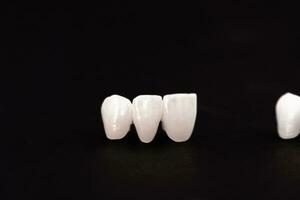 les dents implant et couronne installation processus les pièces isolé sur une noir Contexte. médicalement précis 3d modèle. photo