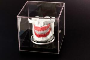 Humain mâchoire avec les dents implants anatomie modèle isolé sur noir Contexte dans une verre boîte. photo