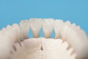 plus haut Humain mâchoire avec les dents anatomie modèle isolé sur bleu Contexte. en bonne santé dents, dentaire se soucier et orthodontique médical concept. photo