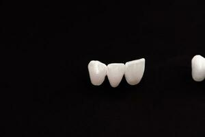 les dents implant et couronne installation processus les pièces isolé sur une noir Contexte. médicalement précis 3d modèle. photo