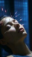 une femme recevoir acupuncture traitement ai généré photo