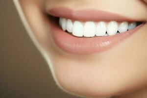 parfait en bonne santé les dents sourire de une Jeune femme à une dentiste. les dents blanchiment. dentaire se soucier, stomatologie concept par ai généré photo