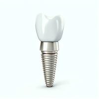 proche en haut de une dentaire dent implant ou en bonne santé Humain dents. blanc émail et dentaire implants chirurgie concept par ai généré photo