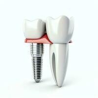 proche en haut de une dentaire dent implant ou en bonne santé Humain dents. blanc émail et dentaire implants chirurgie concept par ai généré photo