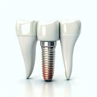 proche en haut de une dentaire dent implant ou en bonne santé Humain dents. blanc émail et dentaire implants chirurgie concept par ai généré photo