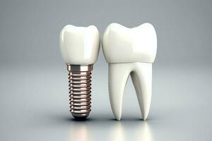 proche en haut de une dentaire dent implant ou en bonne santé Humain dents. blanc émail et dentaire implants chirurgie concept par ai généré photo