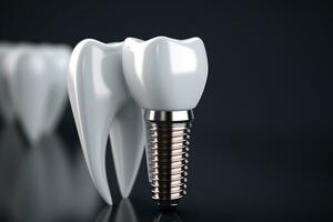 3d généré dentaire les dents implant.santé concept.créé avec génératif ai technologie. photo