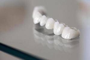 Plaque dentaire en porcelaine de zirconium dans un magasin de dentiste photo