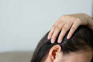 une femme a problèmes avec cheveux et cuir chevelu, elle a pellicules de allergique réactions à shampooings. et cheveux Conditionneur photo