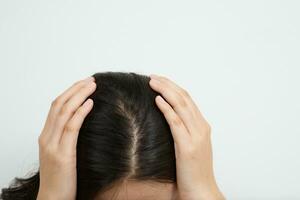 une femme a problèmes avec cheveux et cuir chevelu, elle a pellicules de allergique réactions à shampooings. et cheveux Conditionneur photo