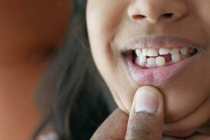 détail coup de enfant avec les dents disparu photo