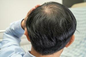 chauve au milieu de la tête et ne commence pas à perdre les cheveux glabres d'un homme de bureau actif et intelligent d'affaires asiatiques matures. photo