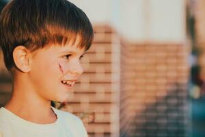 portrait de une souriant enfant avec une cicatrice sur le sien visage photo