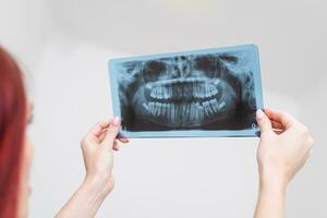 médecin orthodontiste analyses le orthopantomogramme de le les patients mâchoires à diagnostiquer photo