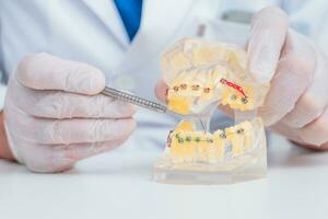 médecin orthodontiste spectacles Comment le système de un appareil dentaire sur les dents est arrangé photo