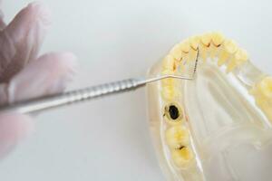 médecin orthodontiste spectacles le instrument sur carie dans le les dents photo