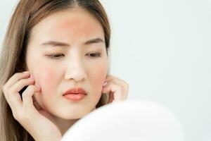 Jeune femme asiatique sont inquiet à propos visages dermatologie et allergique à stéroïdes dans produits de beauté. sensible peau, rouge visage de coup de soleil, acné, allergique à produits chimiques, téméraire sur affronter. peau problèmes et beauté photo